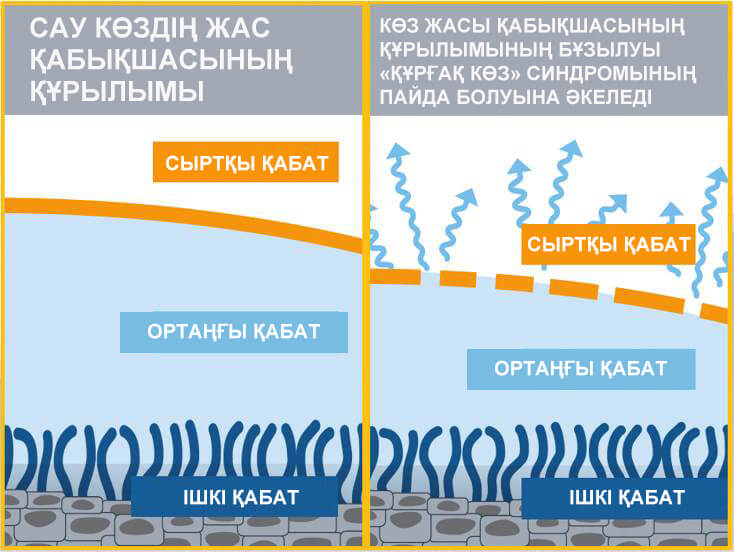Симптомы синдрома «сухого глаза»